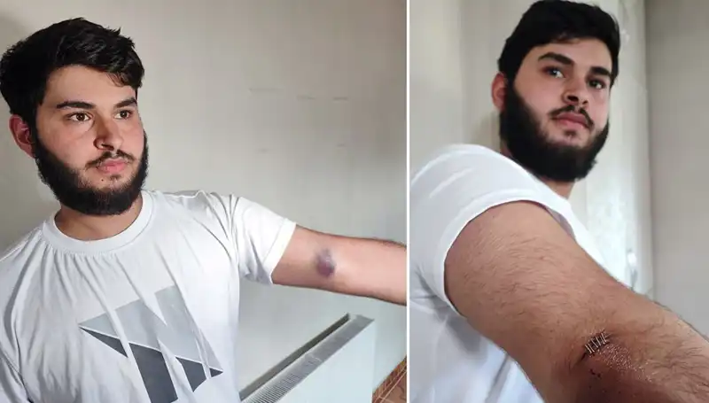 Bahçeye Kaçan Top Mahalleyi Karıştırdı: "Conolar Kamyonetle Geldi"