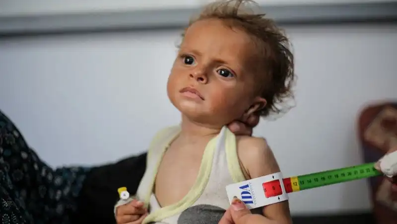 İngiltere, Gazze'deki 300 Çocuğa Yeni Umut Kapılarını Açıyor